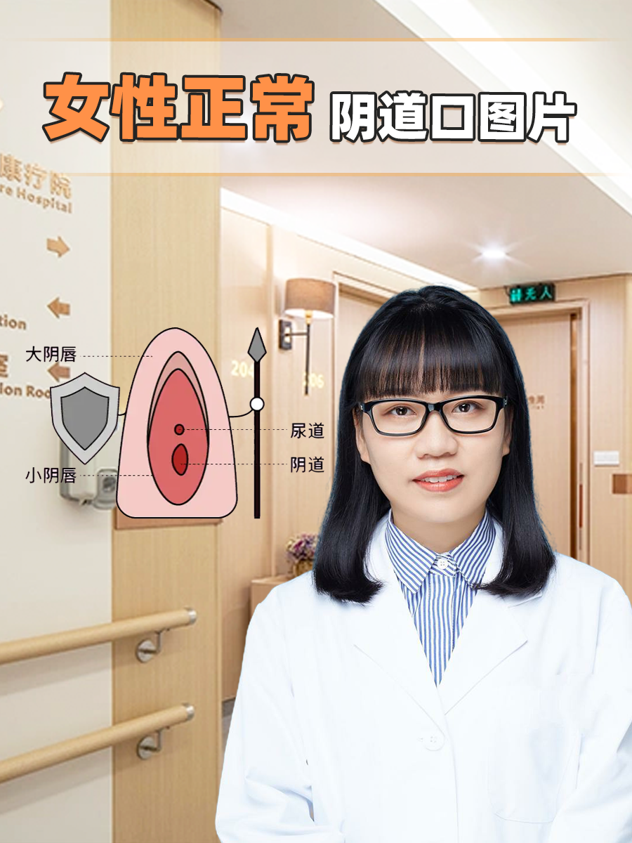 女性正常阴道口图片