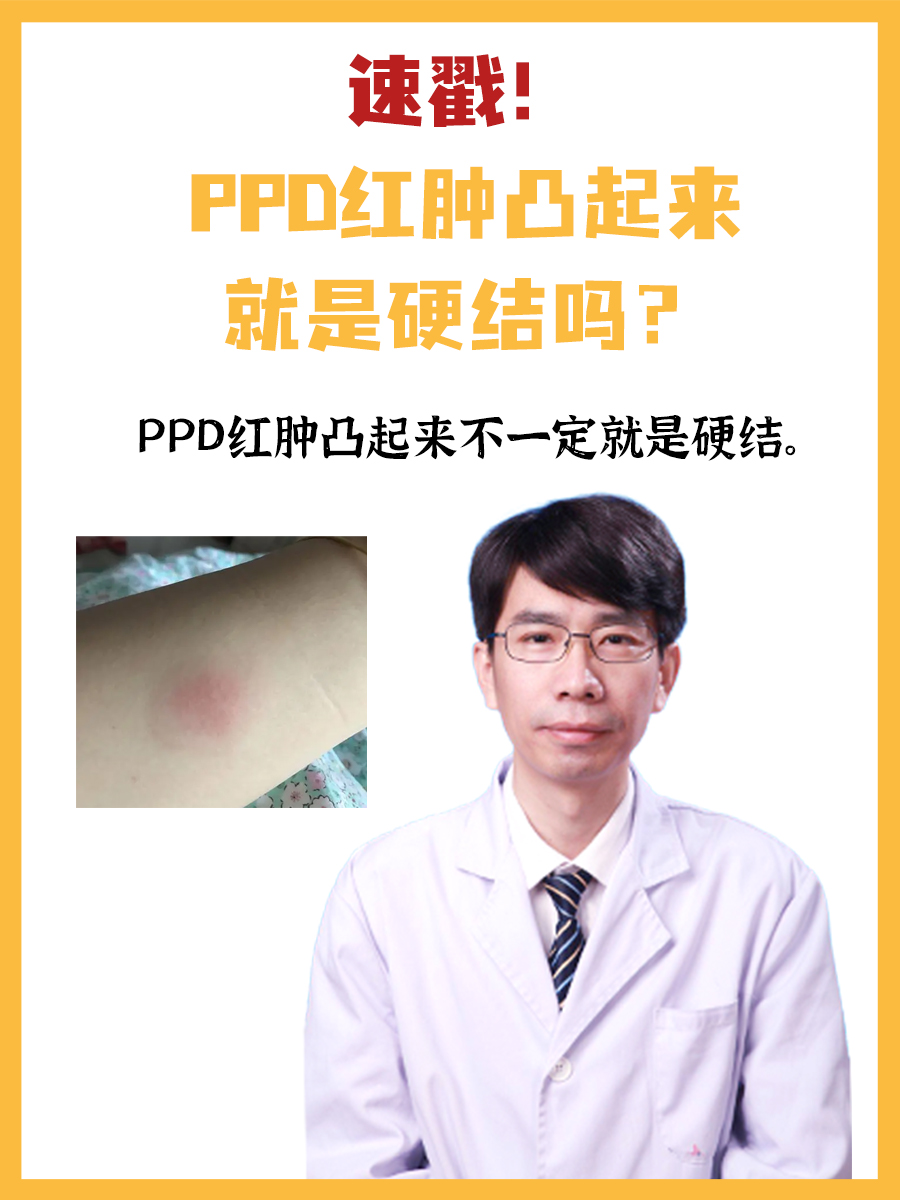 速戳！PPD红肿凸起来就是硬结吗？