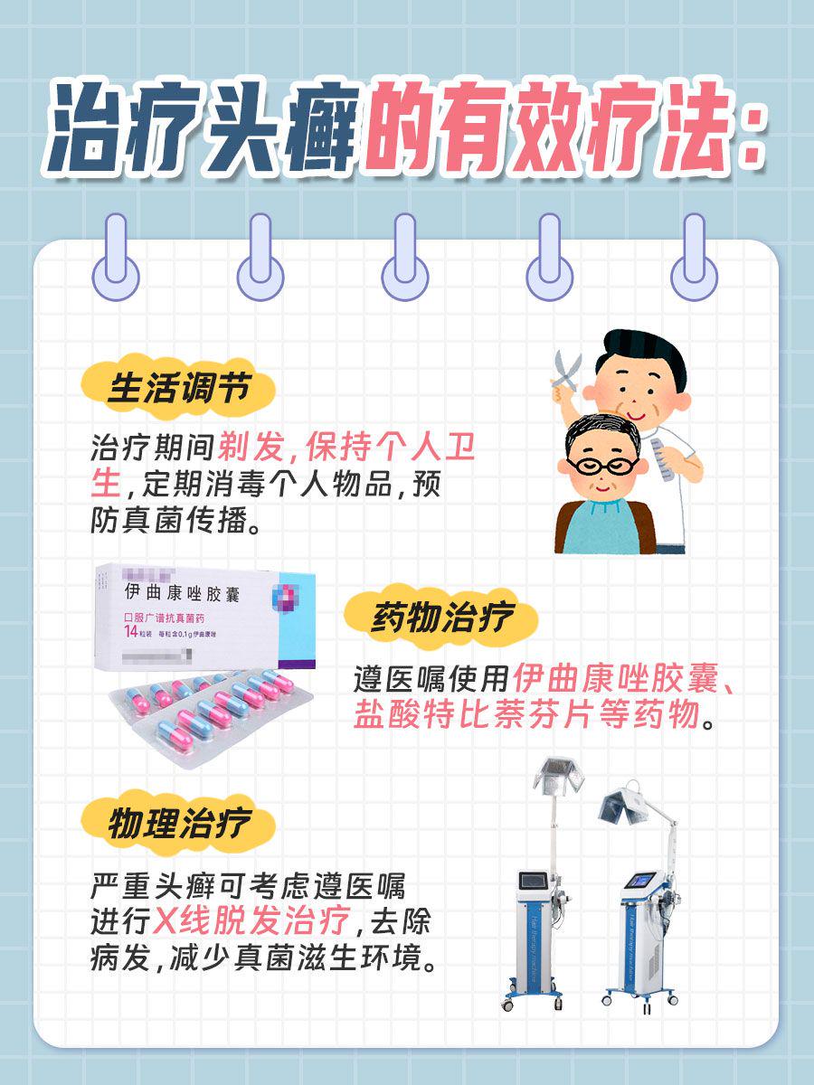 告别头癣烦恼，解锁高效治疗新秘籍！