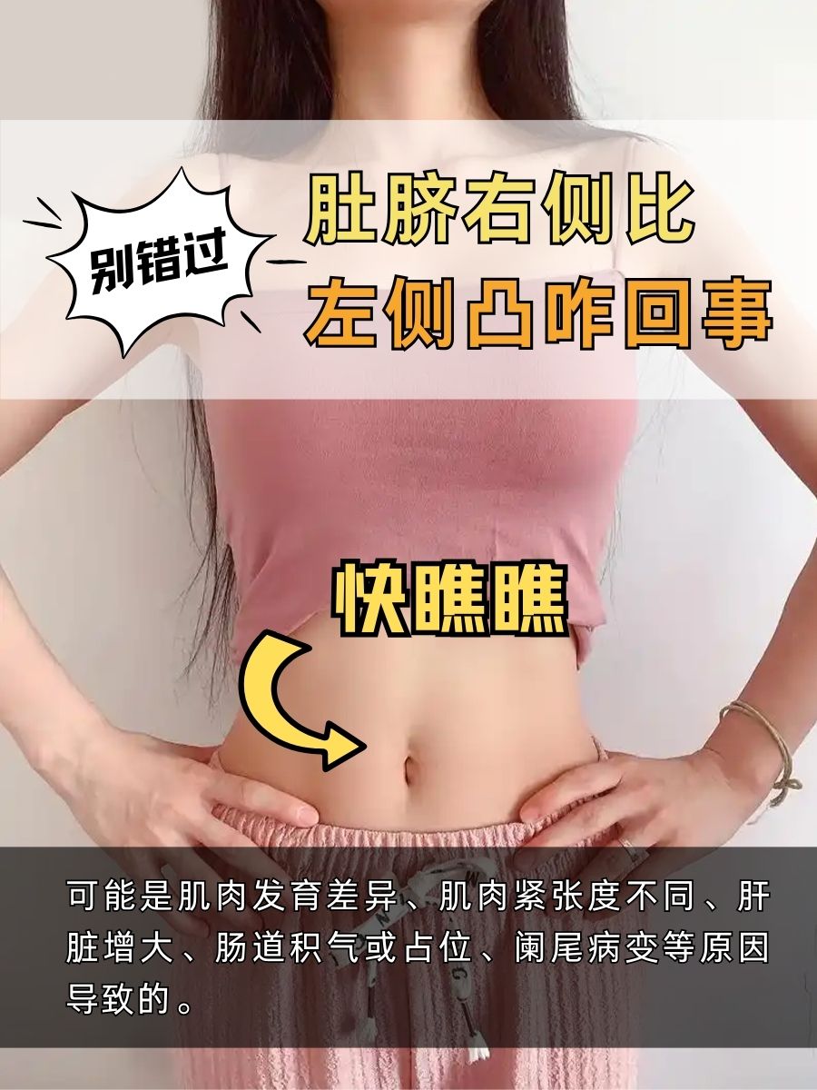 别错过！肚脐右侧比左侧凸咋回事？快瞧瞧