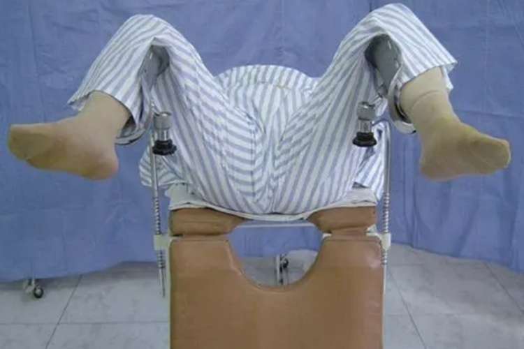 截石位姿势图 截石位姿势图