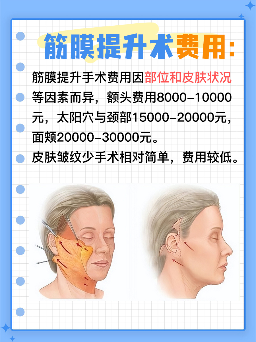 筋膜提升手术多少钱？全面解析