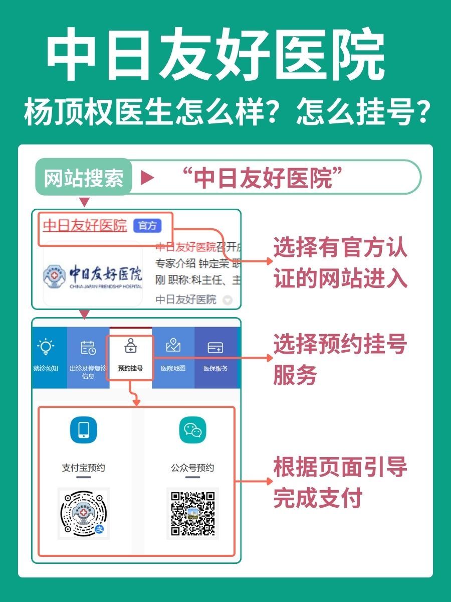 中日友好医院杨顶权医生怎么样？怎么挂号？