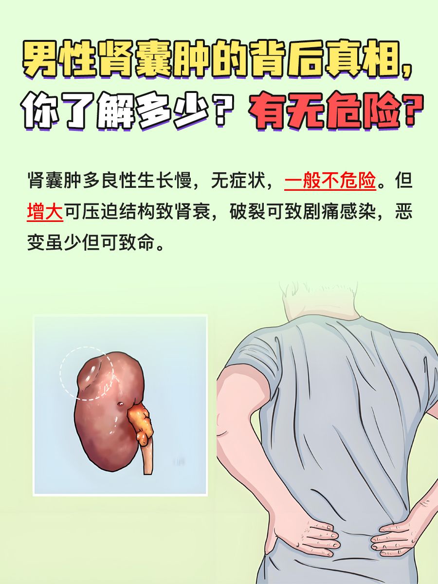 男性肾囊肿的背后真相，你了解多少？有无危险？