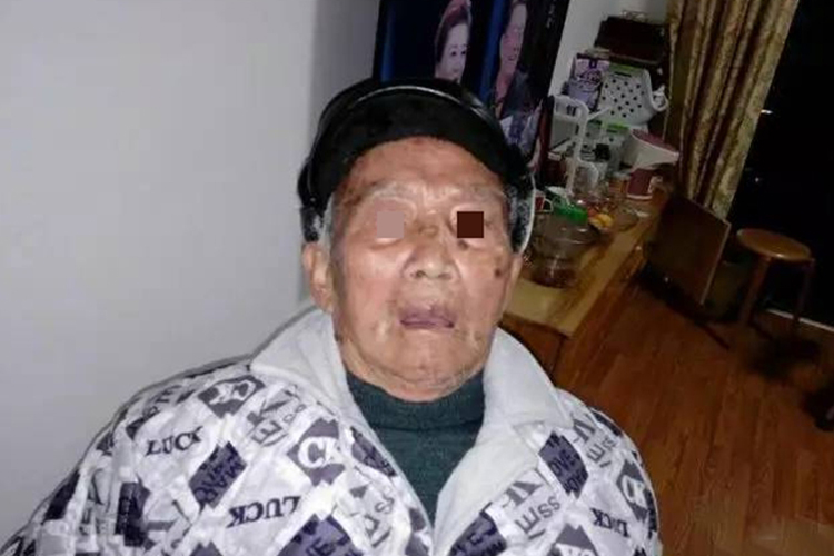 脑梗致血管性痴呆后遗症图 脑梗致血管性痴呆后遗症图