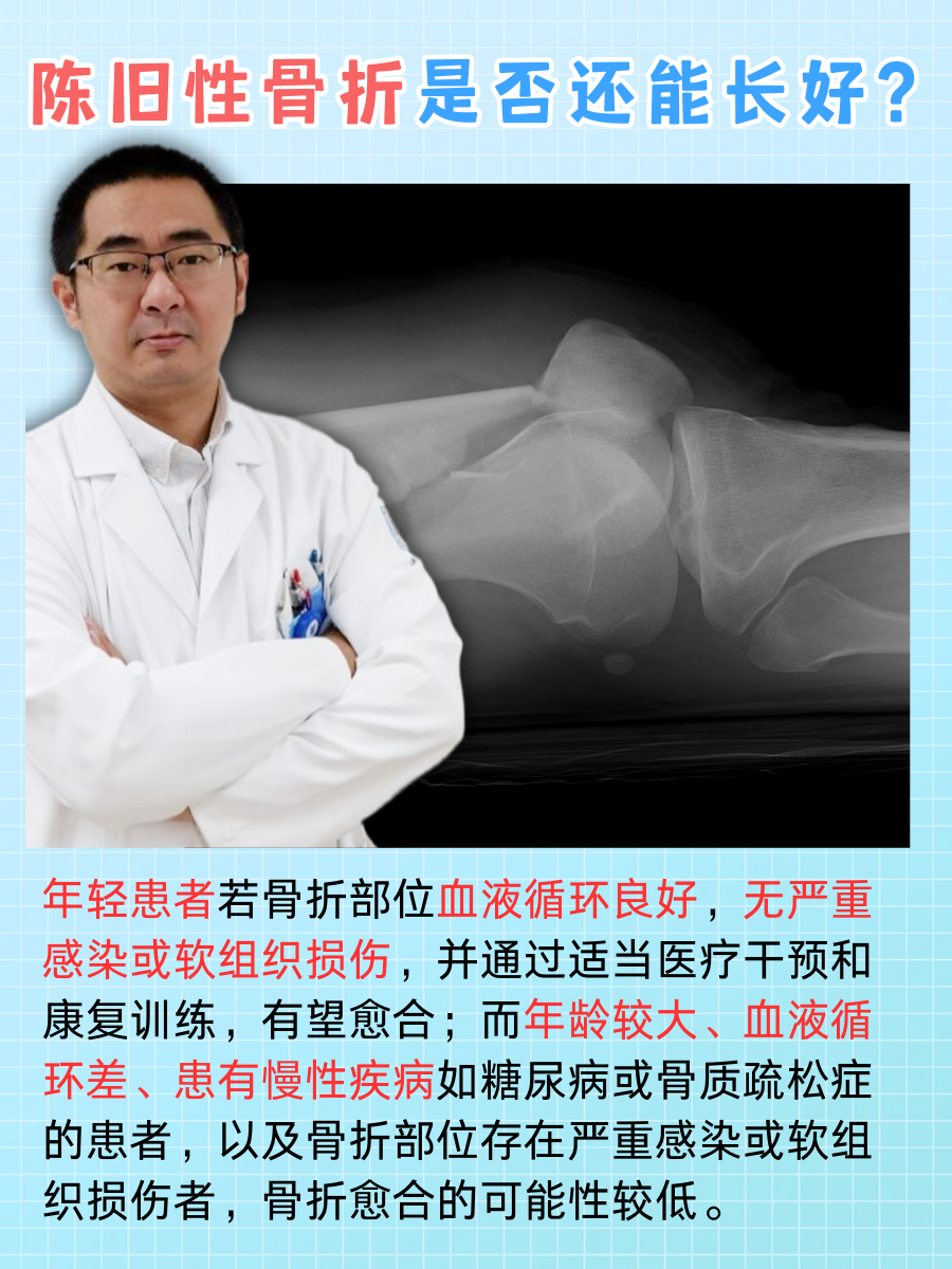 陈旧性骨折恢复可能性评估：如何促进愈合？
