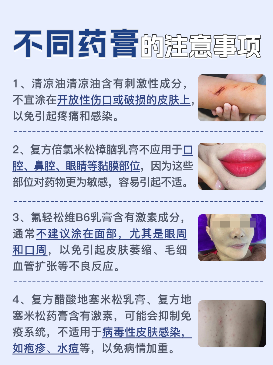 止痒药膏有哪些？医生告诉你