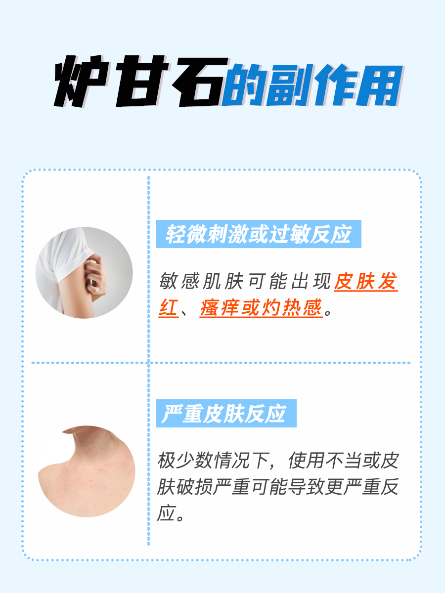 炉甘石毒性揭秘，它的危险性你了解吗？