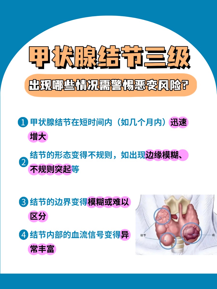 注意!甲状腺结节三级,这是啥程度了?