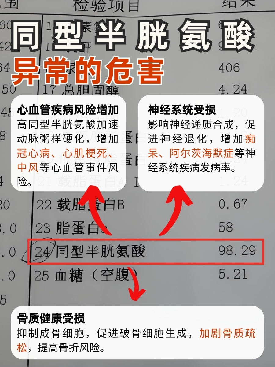 必知!同型半胱氨酸属于肝功能吗?