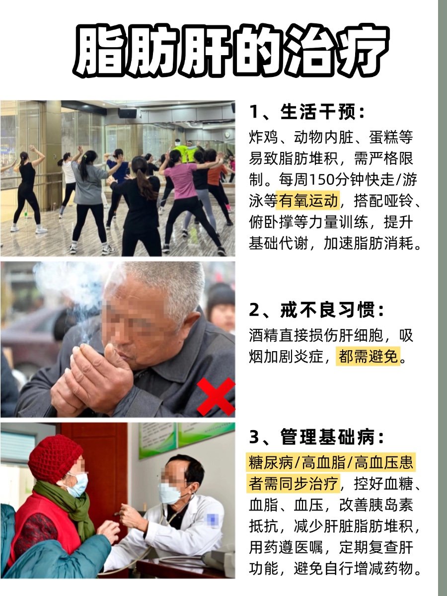 脂肪肝什么原因,怎么治疗?应对方法来啦!