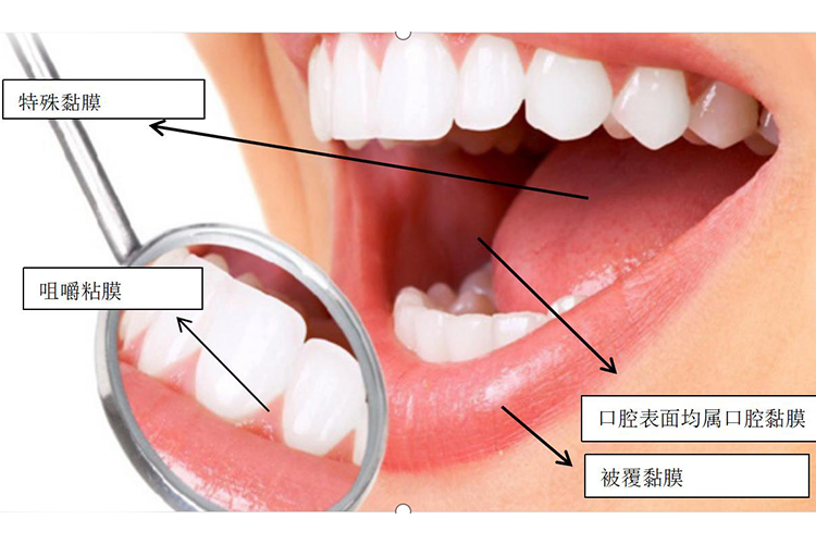 口腔黏膜图