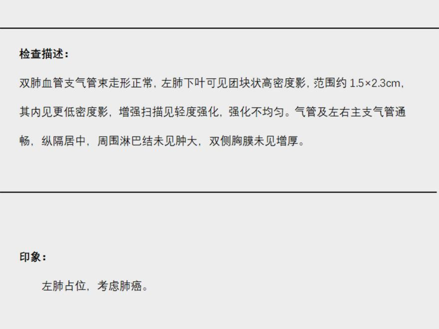 小细胞肺癌（37岁小伙确诊小细胞肺癌，手术+放疗成功控制肿瘤！）.png