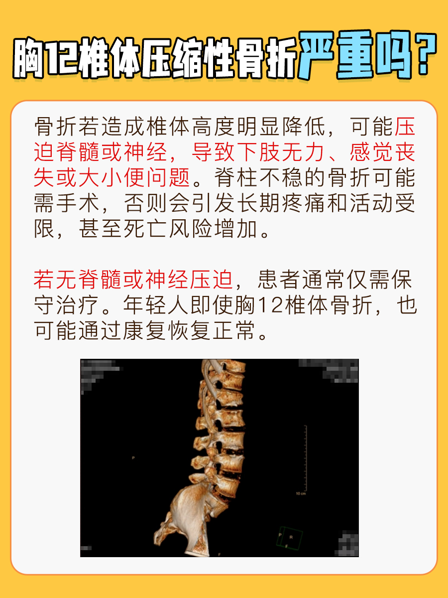 胸12椎体压缩性骨折严重吗？真相来了