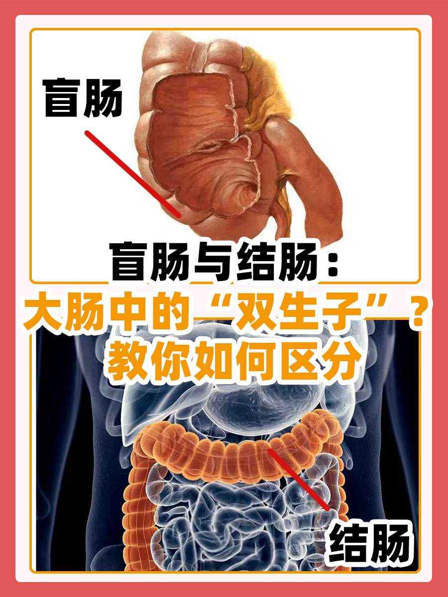 盲肠与结肠：大肠中的“双生子”？教你如何区分