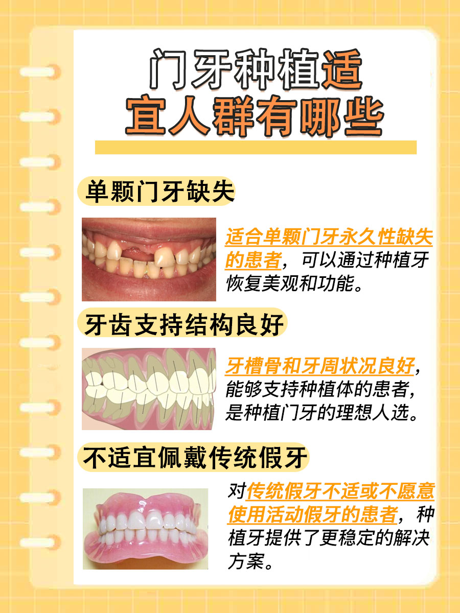 门牙种植牙费用，价格与选择