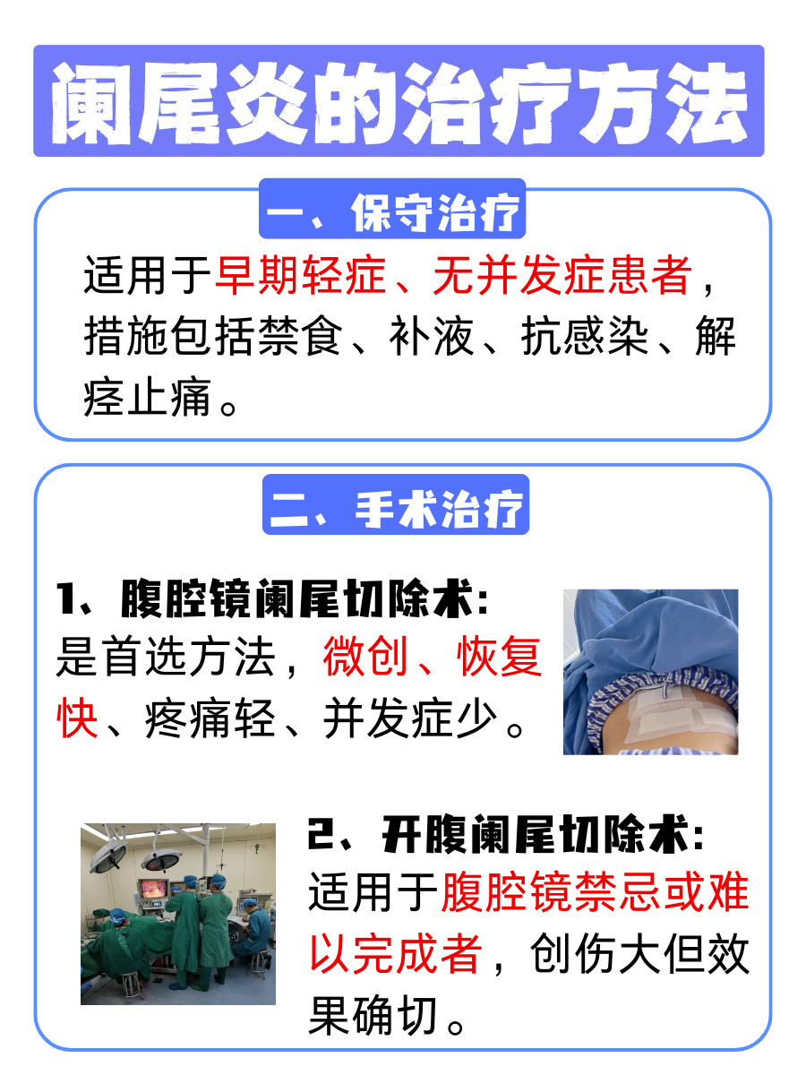 阑尾炎来袭不用怕，自检方法在手，健康我有！
