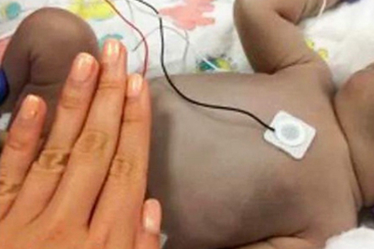 婴儿青铜综合征腹部症状图