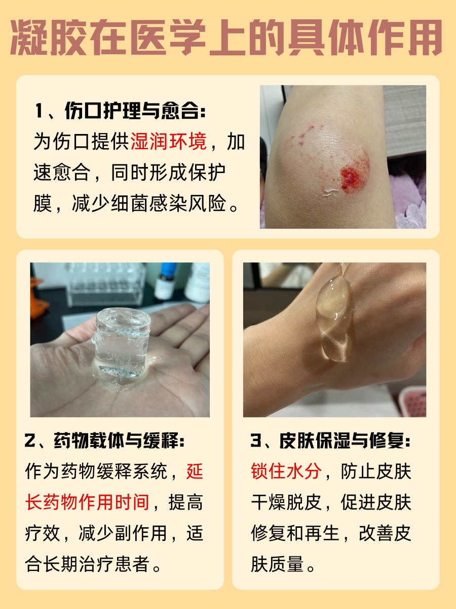 凝胶在医学界，竟有如此神通广大？