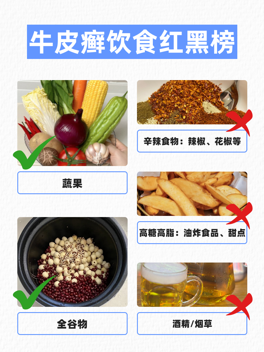 牛皮癣能吃鱼吗？皮肤科医生给你权威答案！