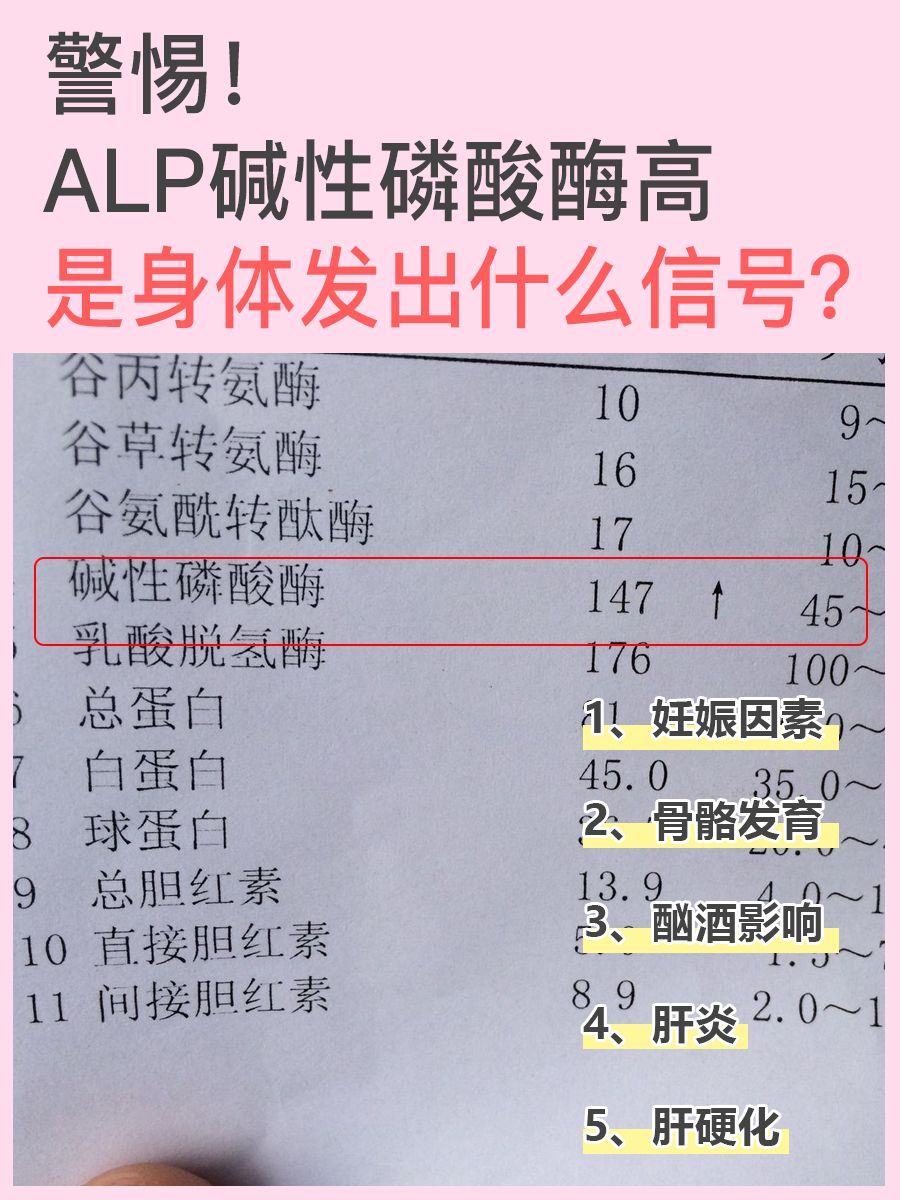 警惕！ALP碱性磷酸酶高是身体发出什么信号？