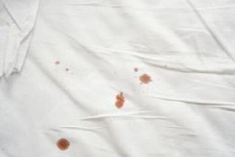 处女膜破裂出血图