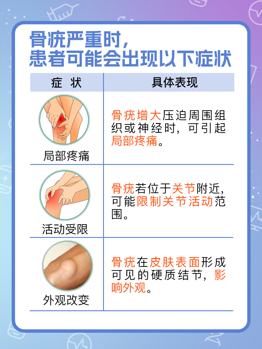 揭秘骨疣:骨骼上的良性小突起