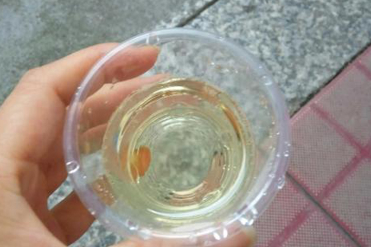 尿酸高正常颜色图