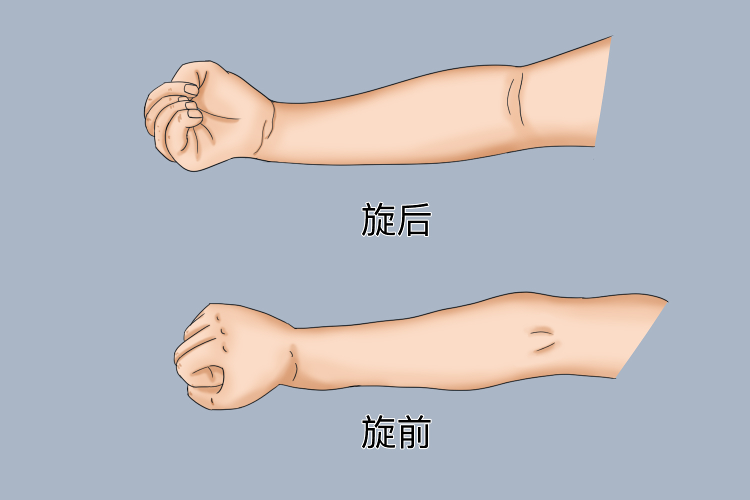 肘关节旋前旋后示意图