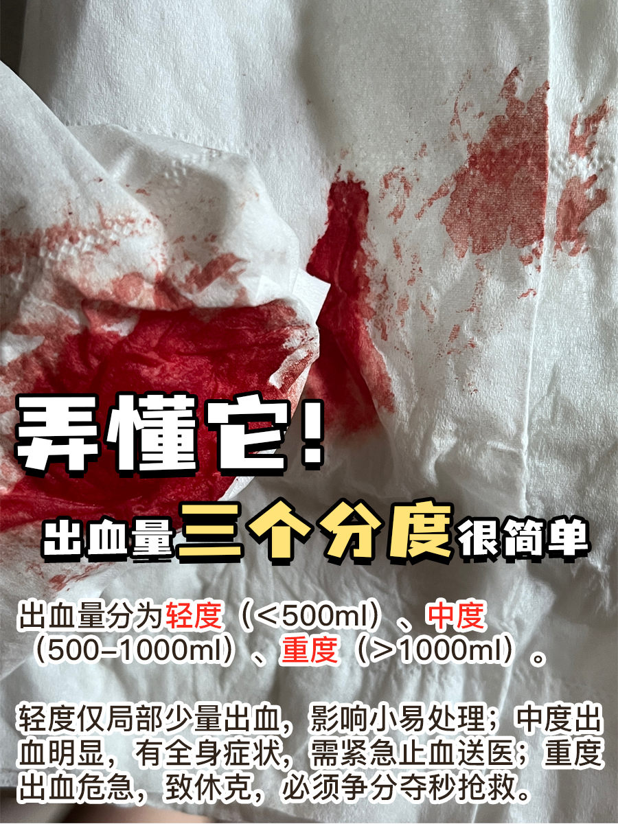弄懂它！出血量三个分度很简单