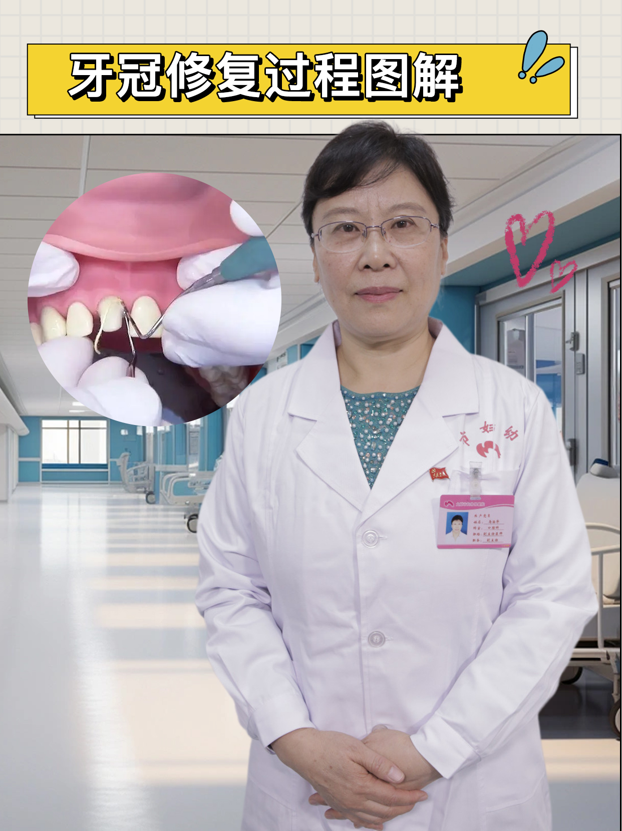 牙冠修复过程图解
