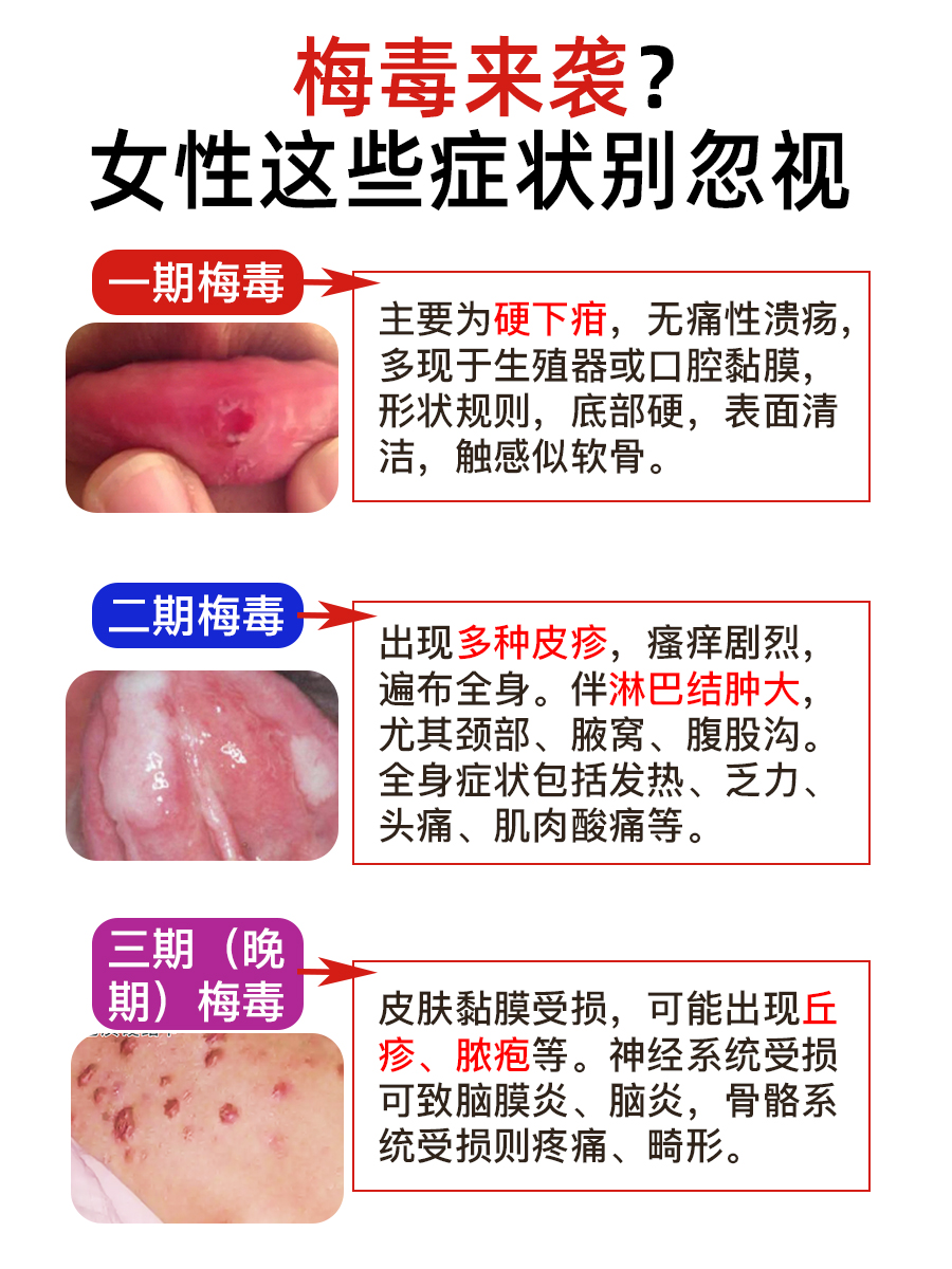 梅毒悄悄靠近？女性自查清单，症状速览