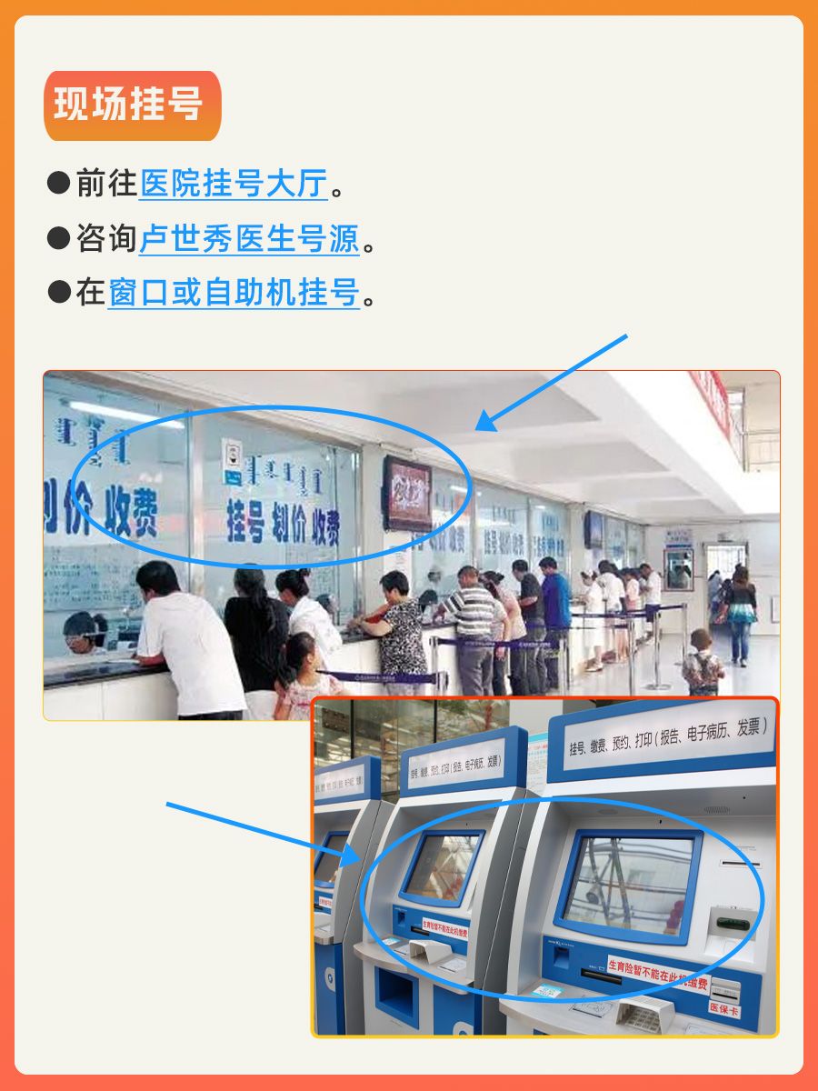 北京大学首钢医院卢世秀医生怎么样？怎么挂号?