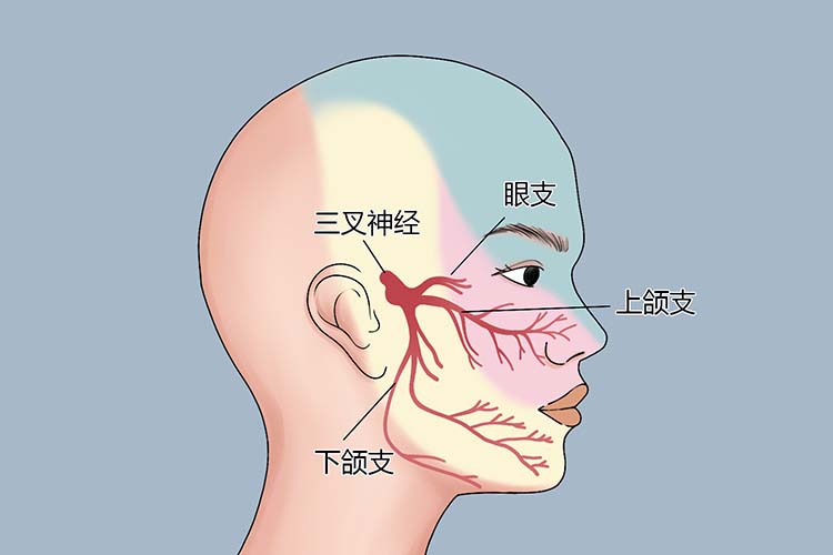 三叉神经痛位置图 三叉神经痛位置图