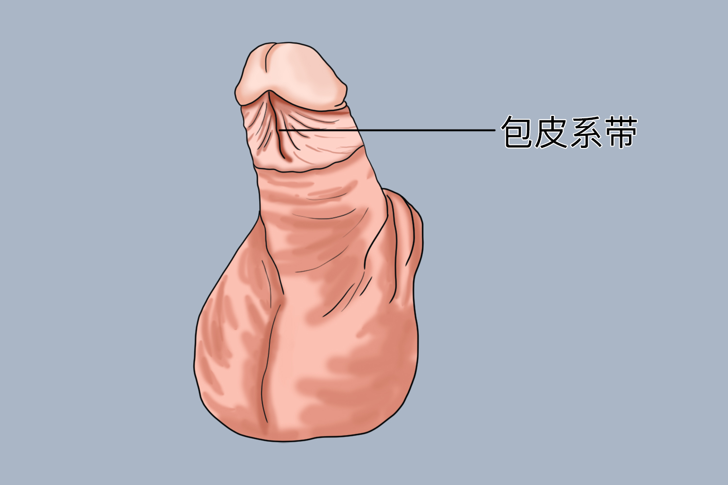 儿童包皮系带图 儿童包皮系带图