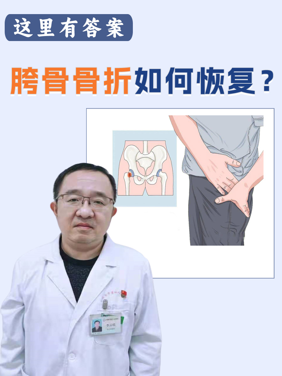 胯骨骨折如何恢复？这里有答案