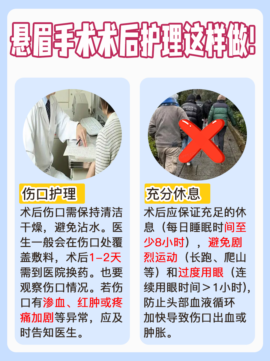 悬眉手术费用解析，大约是这个数！