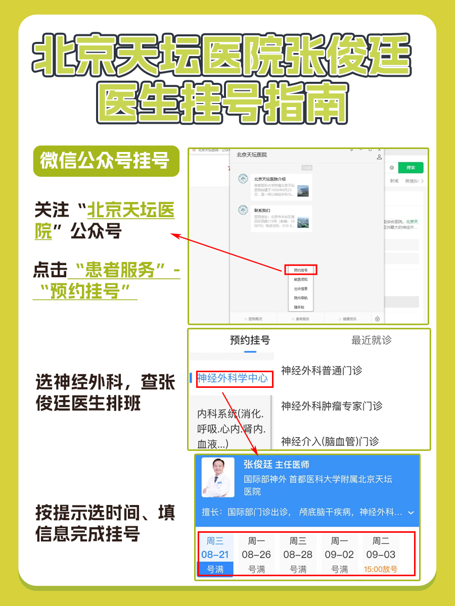 北京天坛医院张俊廷医生怎么样？怎么挂号？