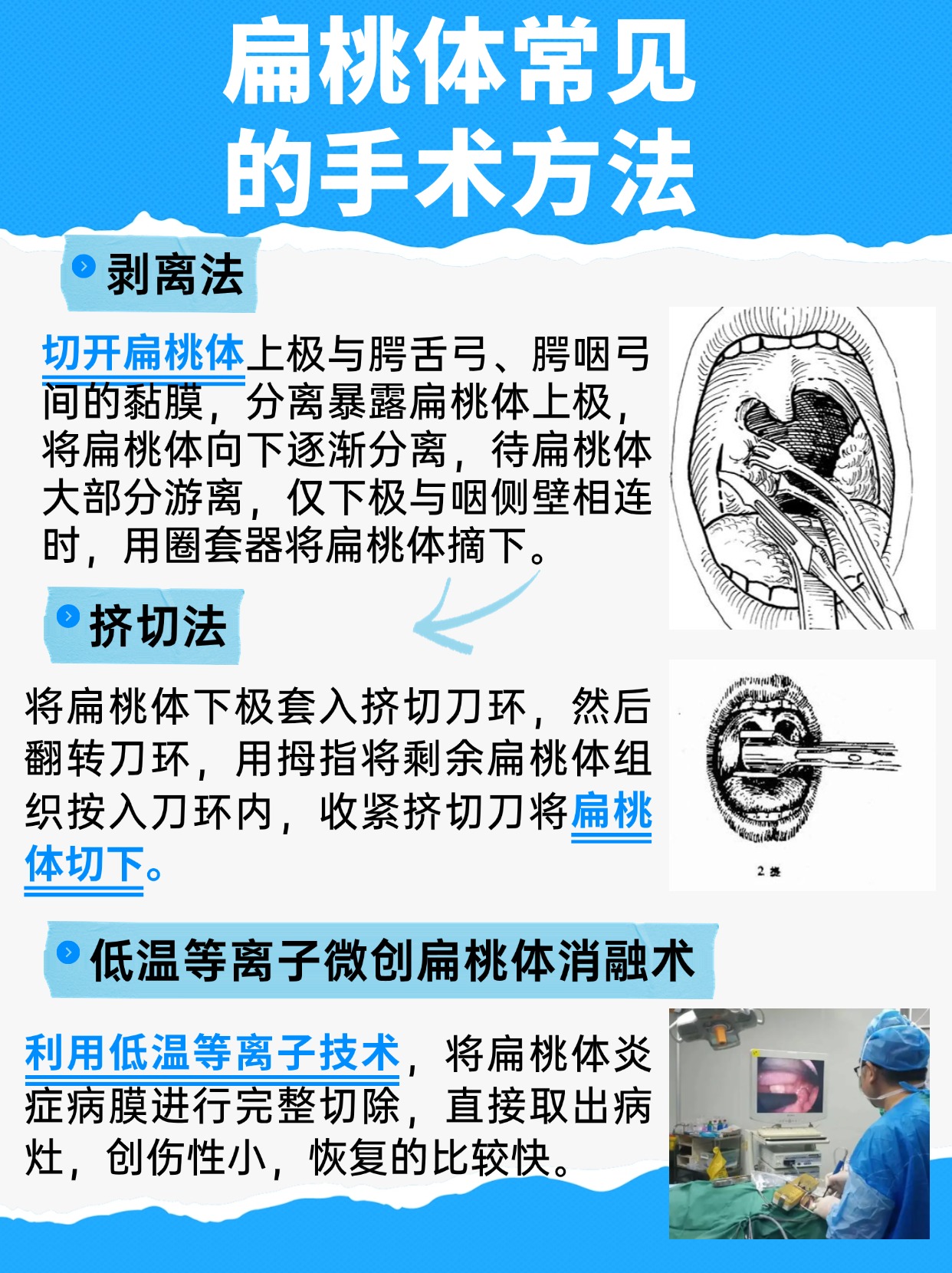 扁桃体术后比较危险的并发症是什么？你是否中招