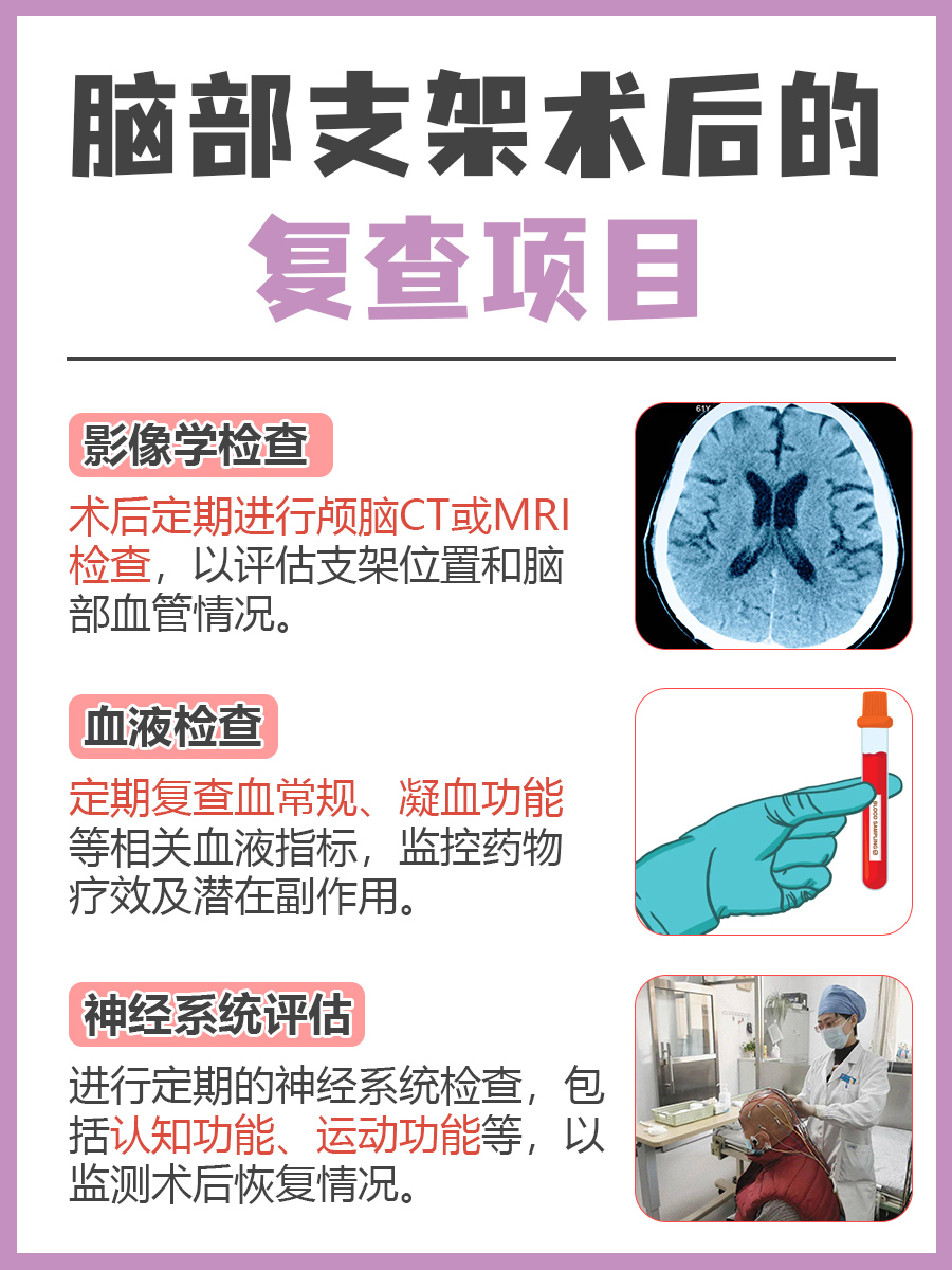 脑部支架术后全面指南：安全恢复