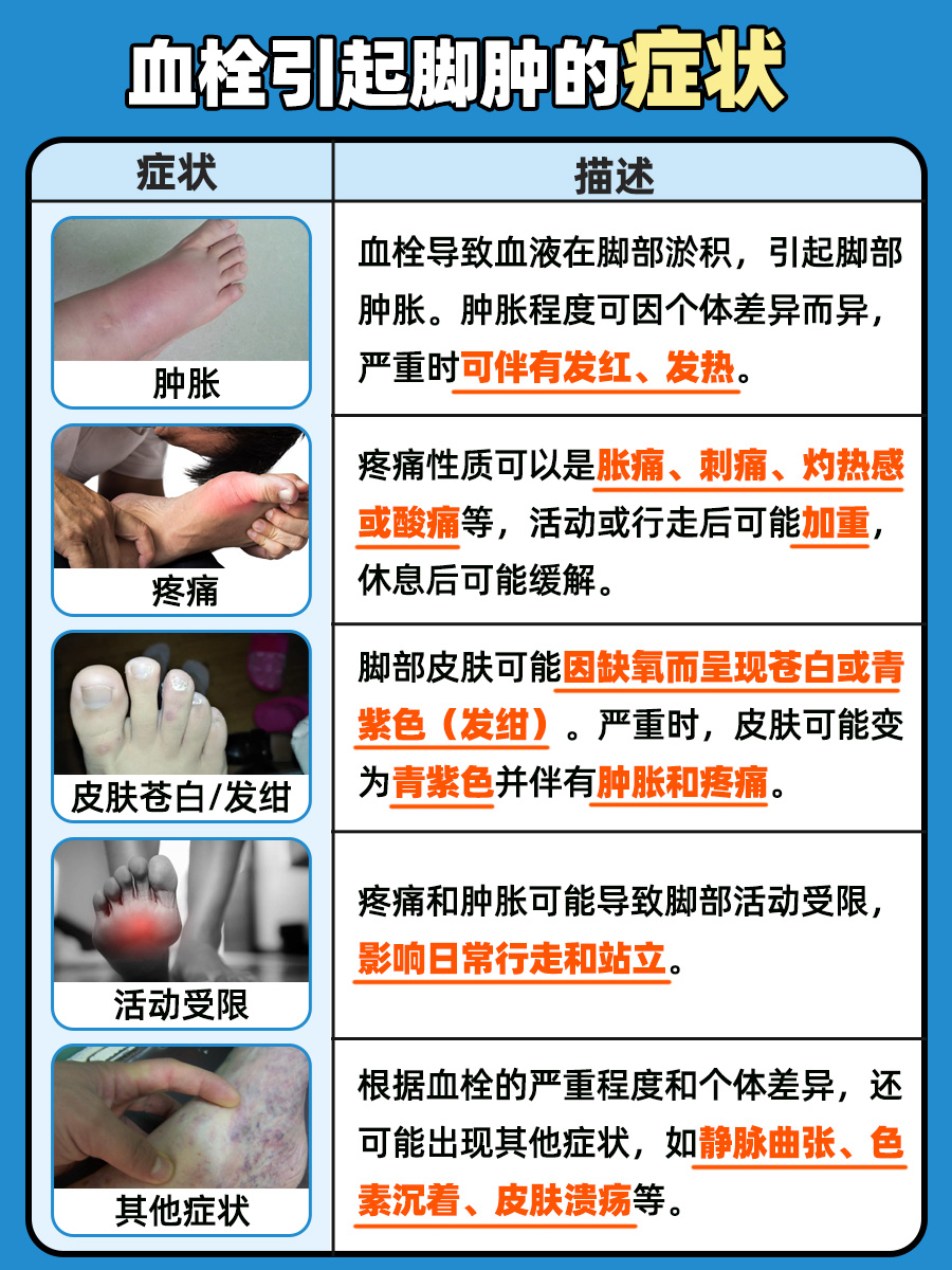 血栓引起脚肿，该怎么办？一文解答！