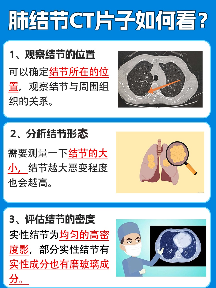 肺结节患者看过来,教你如何看CT片子