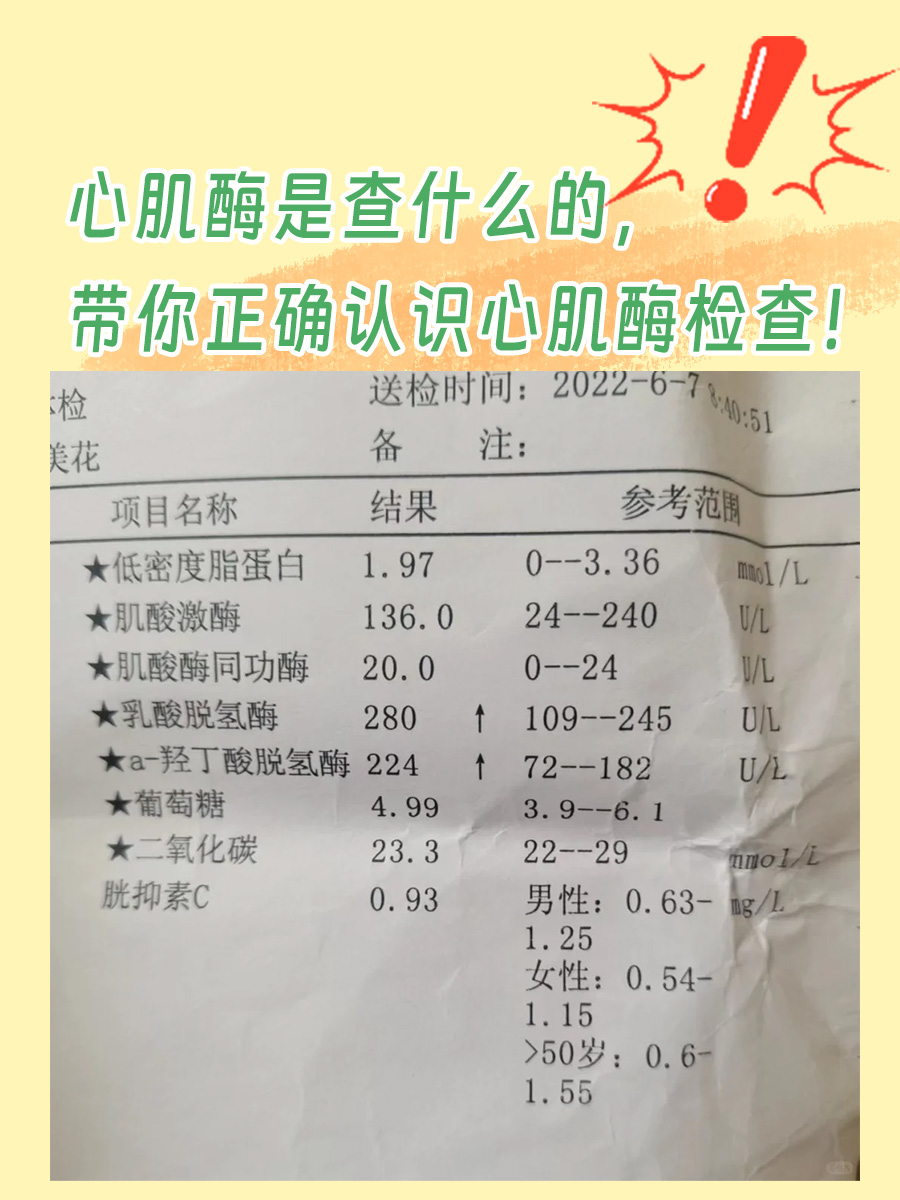 心肌酶是查什么的，带你正确认识心肌酶检查！
