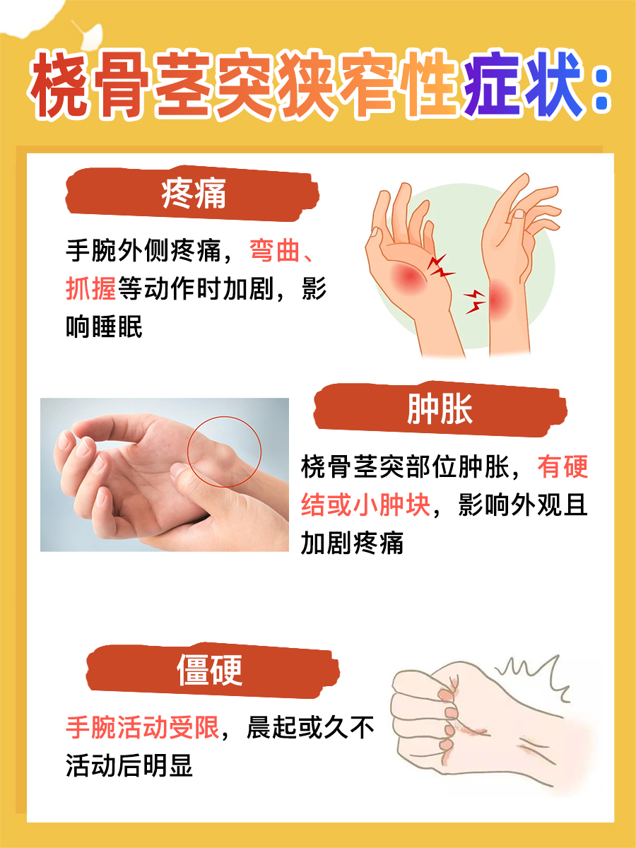 桡骨茎突狭窄性腱鞘炎:了解症状