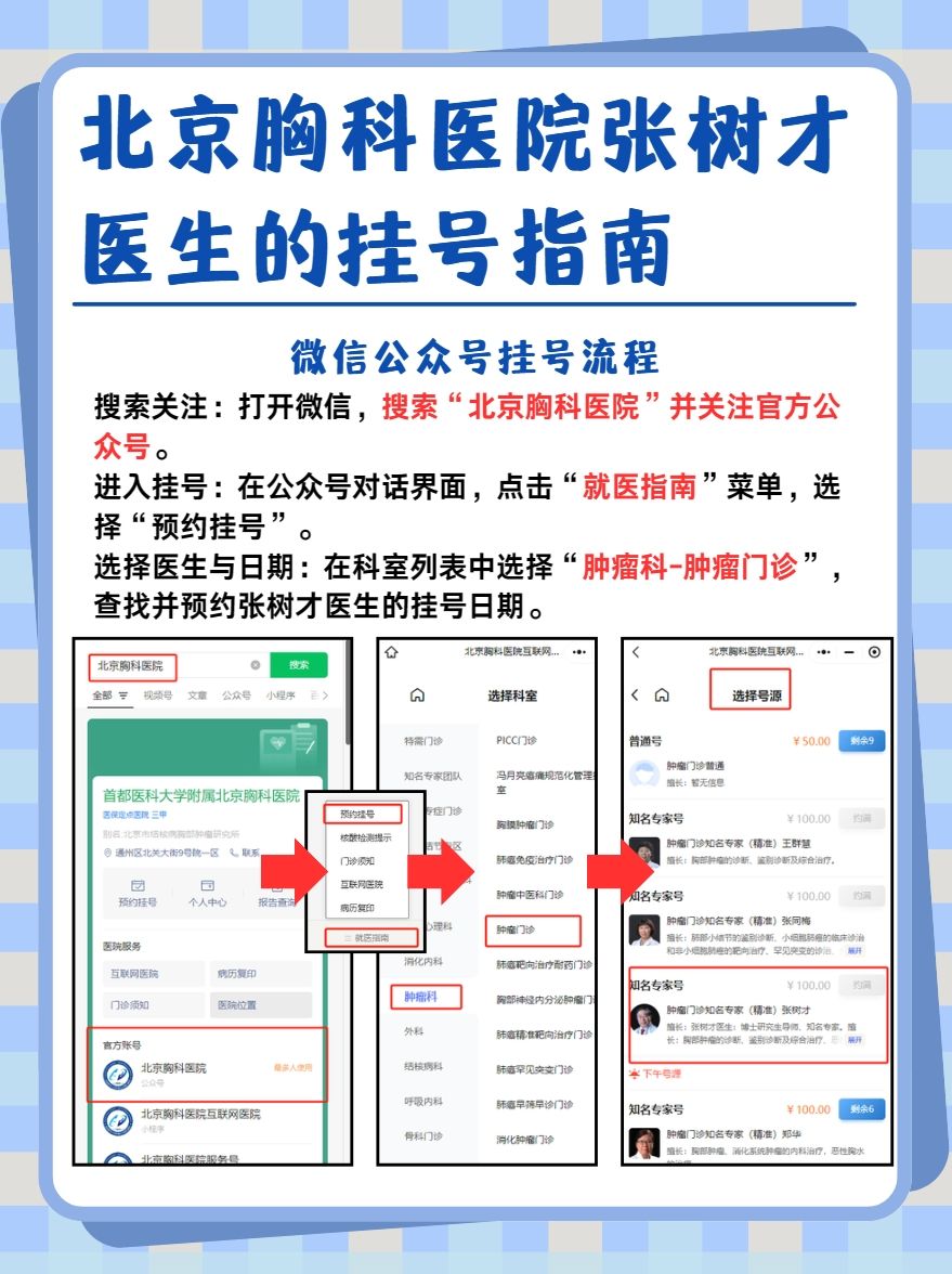 北京胸科医院张树才医生怎么样？怎么挂号？