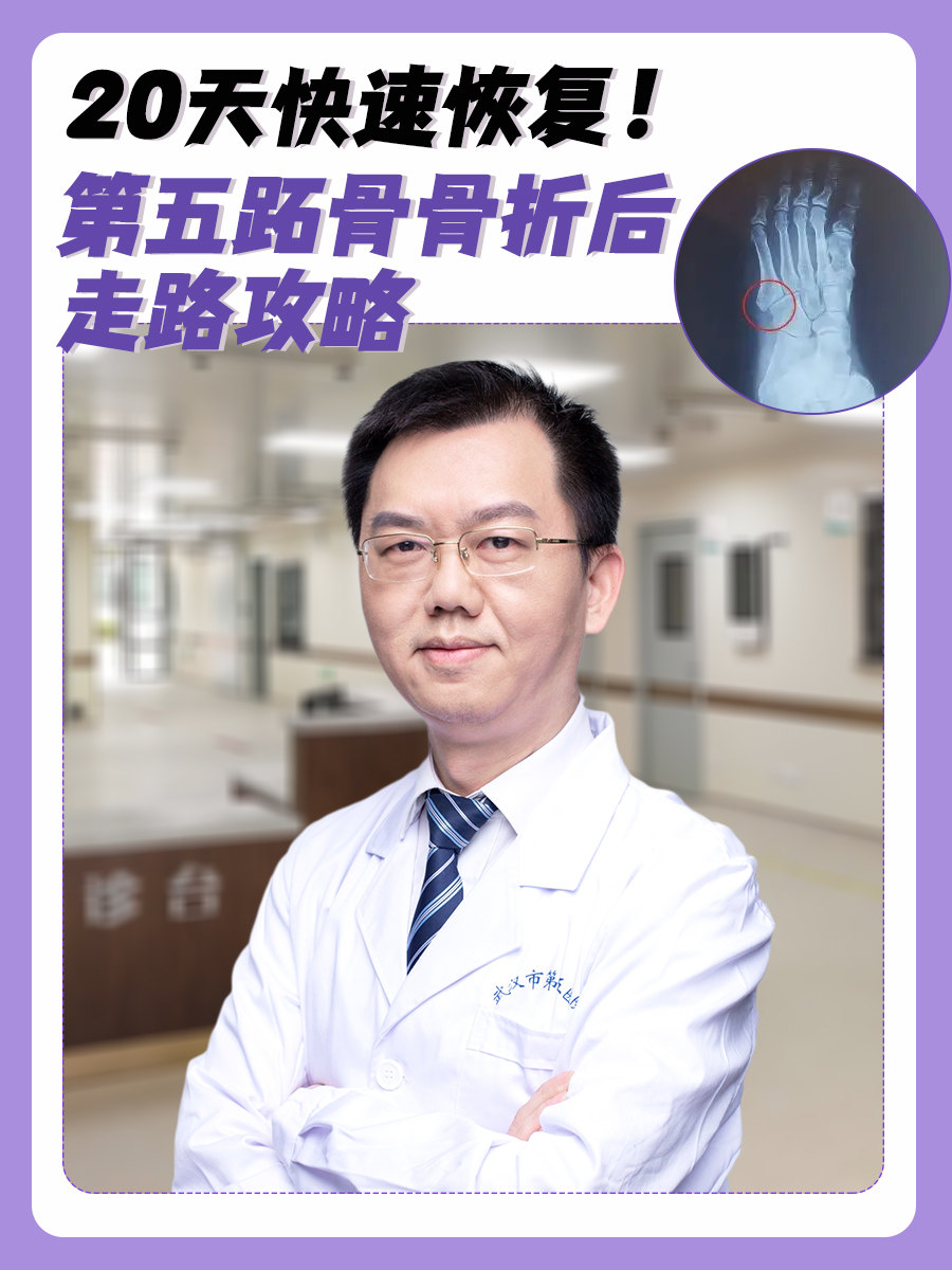 20天快速恢复！第五跖骨骨折后走路攻略