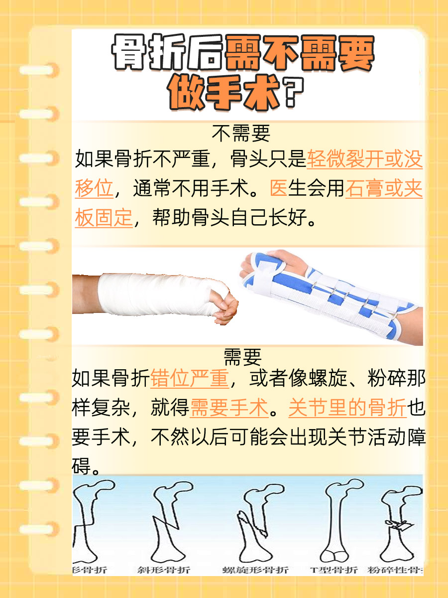 骨折必看！你的骨折情况真的需要手术吗？