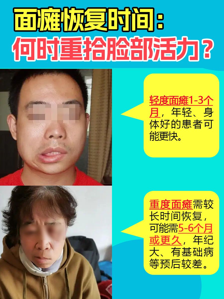 面瘫恢复时间：何时重拾脸部活力？