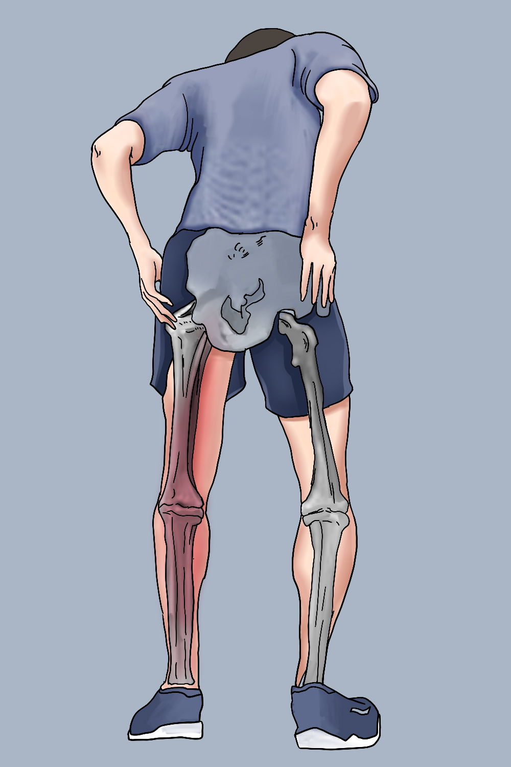 大腿内侧疼痛图