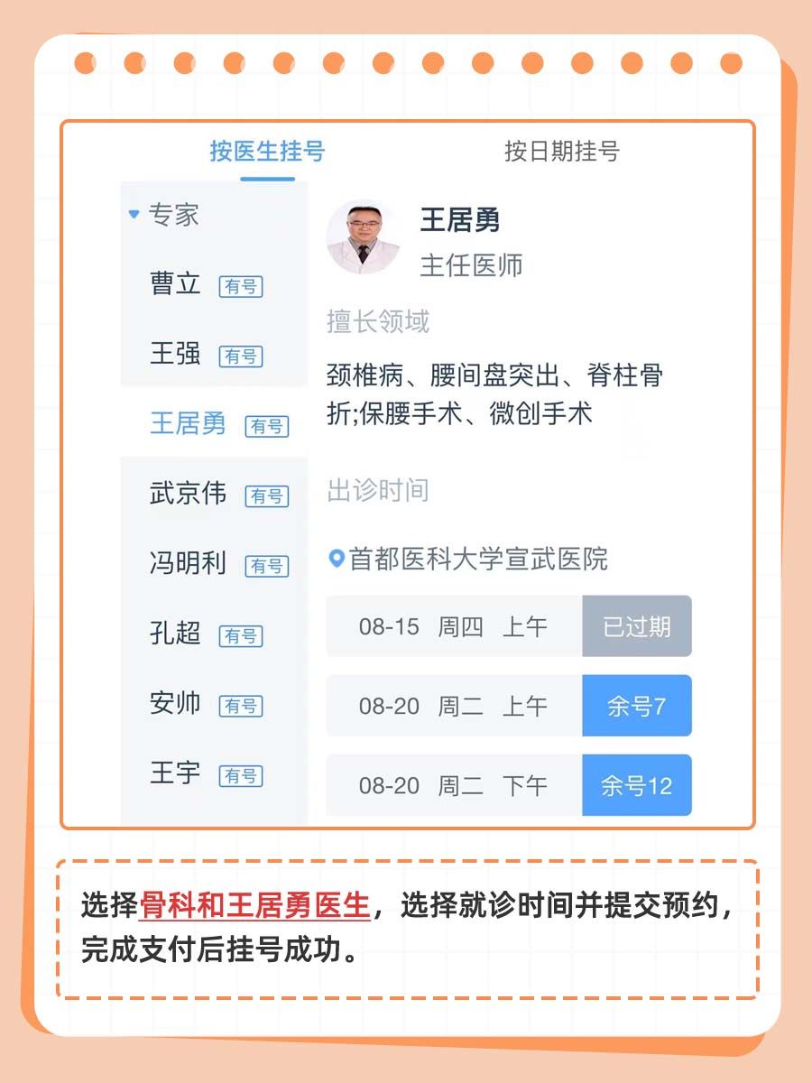 北京宣武医院王居勇医生怎么样？怎么挂号？